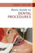 Basic guide to dental procedures. Basic guide to dental procedures.