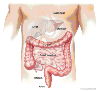 Colorectal_1 Colorectal_1