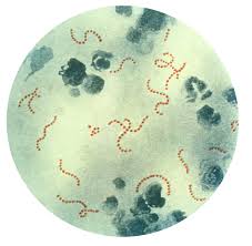 Autoimmunity Autoimmunity