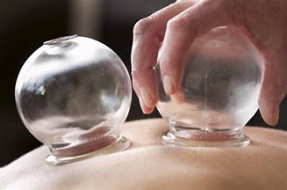 Cupping